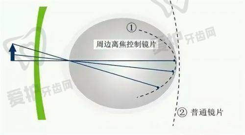 兰州爱尔眼科医院有哪些专精的医疗团队?