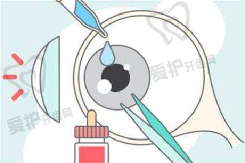选择眼科医院时应考虑哪些因素?