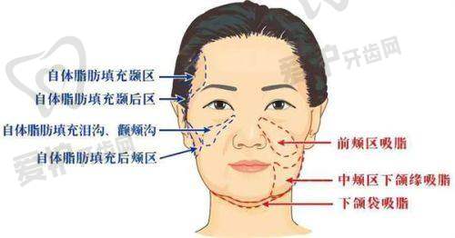 淮安苏王重点整形项目