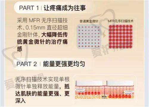 如何选择一家靠谱的医美机构进行黄金微针治疗？
