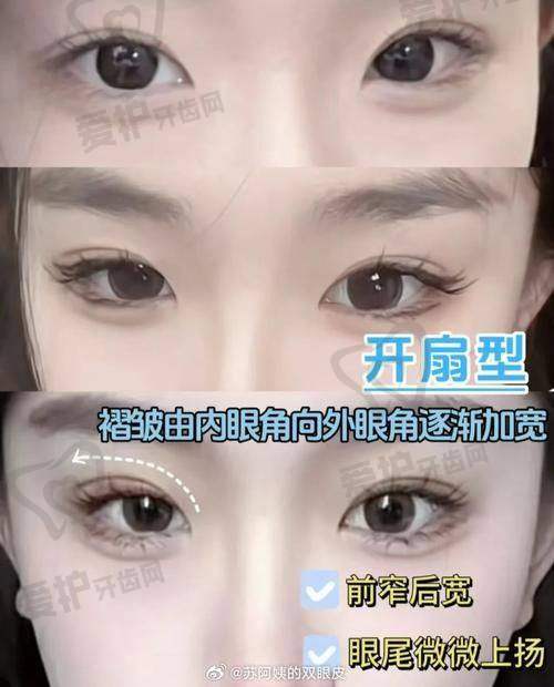 双眼皮手术后的修复过程是怎样的？