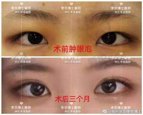 审美眼光如何展现？