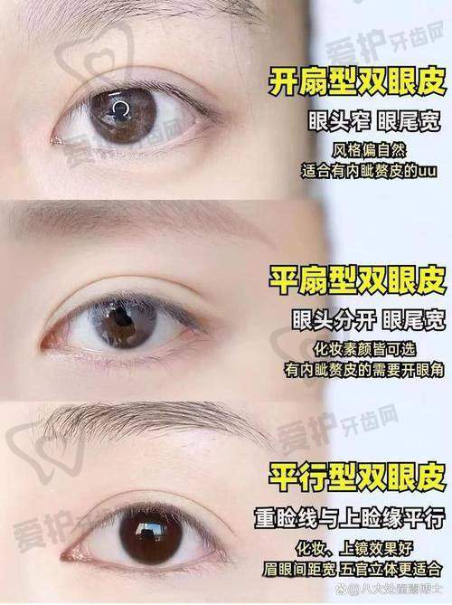 如何选择林靖医生做双眼皮手术？
