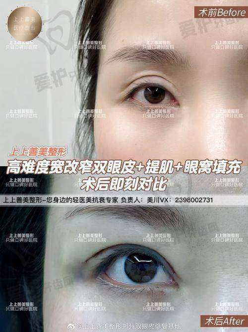 成都纯曦医院的环境和服务如何？