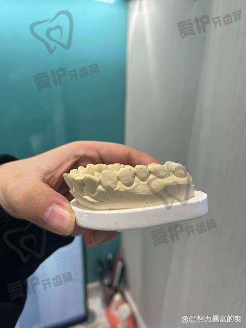 西安双宝口腔于洪海医生开展半口牙种植32000元起，技术靠谱价格优 