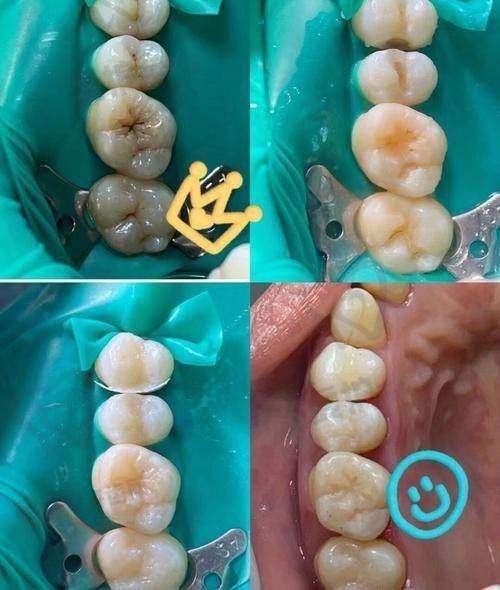 如何选择适合自己的材料？