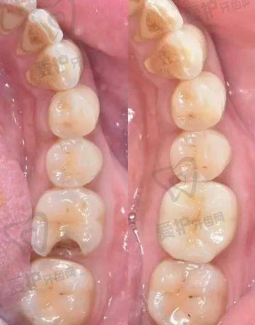 材料技术有何不同？