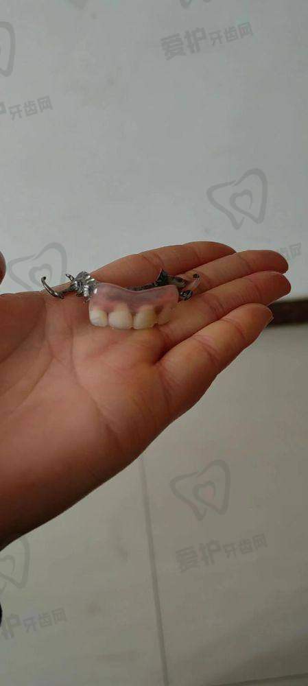 患者使用爱尔创全瓷牙冠的实际体验如何？