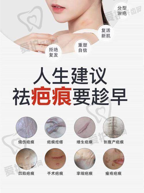 重庆万州区疤痕修复费用一览表