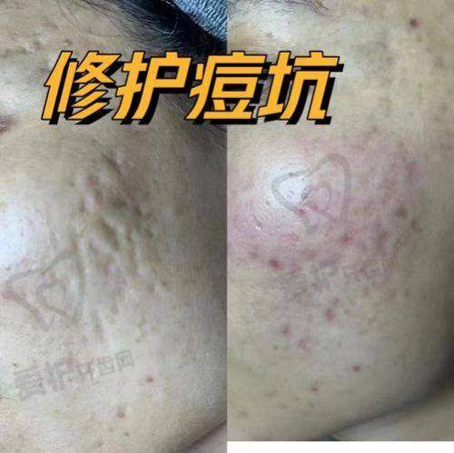 重庆骑士医院疤痕修复科：十年经验铸口碑