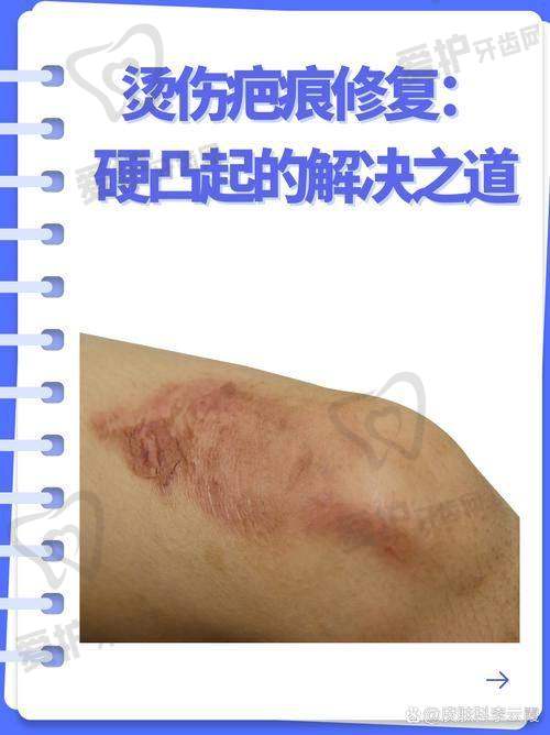 重庆大学附属三峡医院皮肤科：专精团队实力强