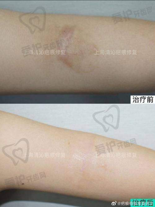 重庆星宸整形美容医院：非侵入性修复骨干医生