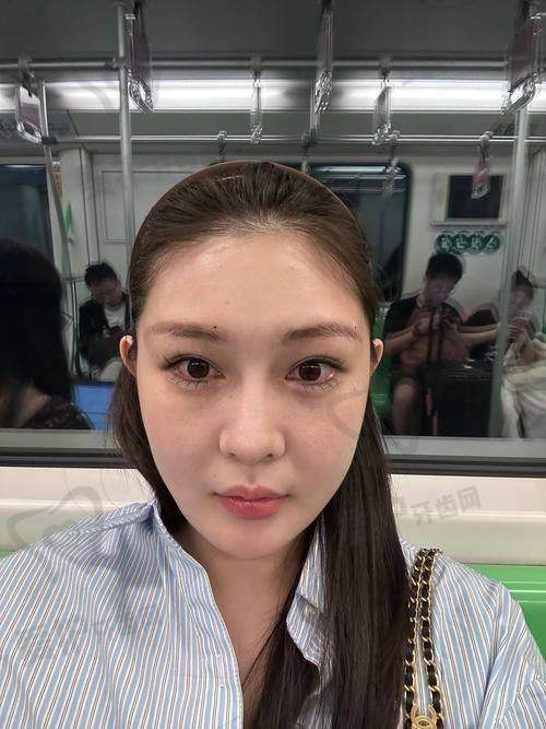 薇旖美胶原蛋白成效维持时长的优势体现在哪里？