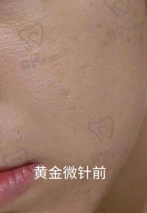 绘梦者联盟