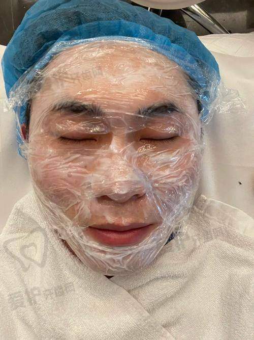 上海韩卓医疗美容的黄金微针项目有哪些优势？