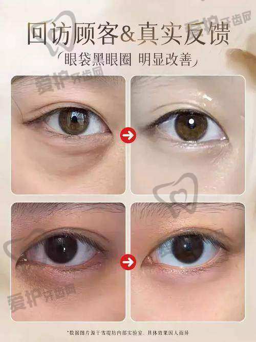 青岛诺美德用薇旖美胶原蛋白打眼周细纹，仅3800元起焕亮眼眸！ 