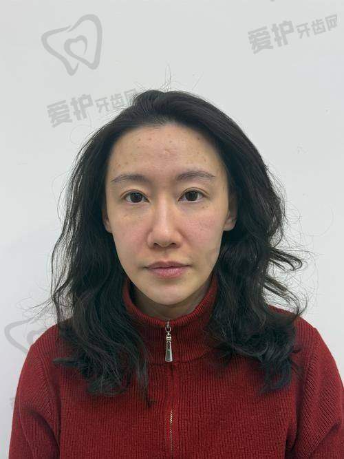 薇旖美胶原蛋白一支的大致价格范围是多少？