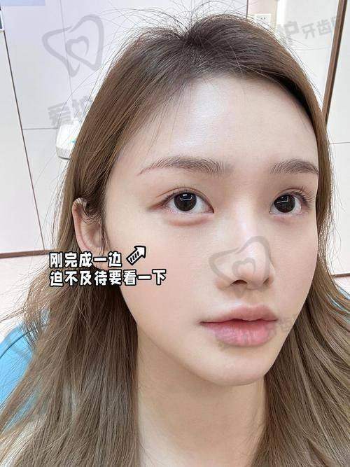 薇旖美胶原蛋白的成效能维持多久？