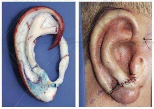 2、郑州东方贺洁医生擅长项目: