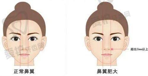 二、福州名韩医疗美容门诊部正规吗?