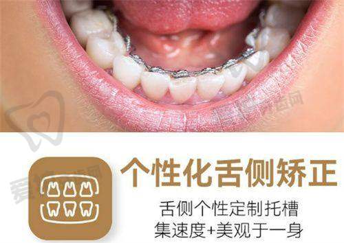 隐形矫正有什么独特之处?