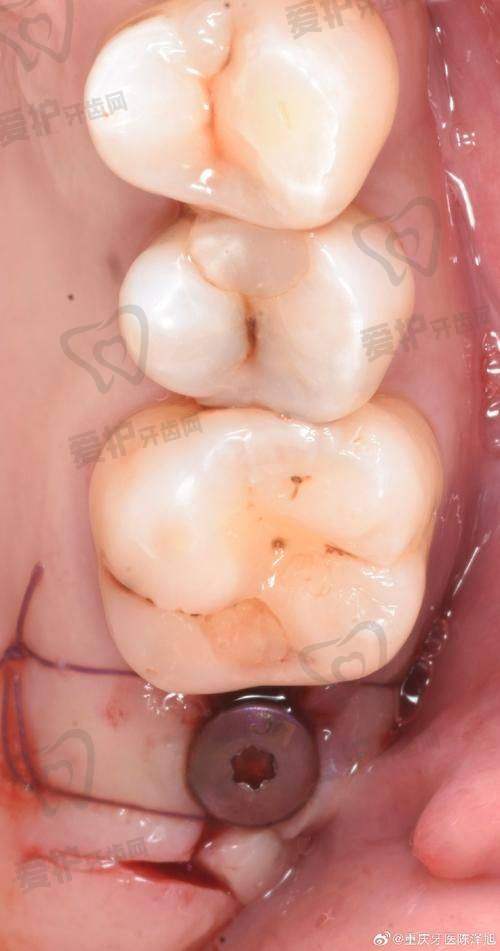 5、福州登特口腔柳书喻医生患者评价: