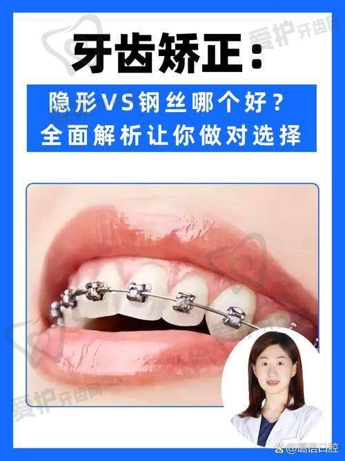 传统金属托槽矫正:价格与成效的平衡