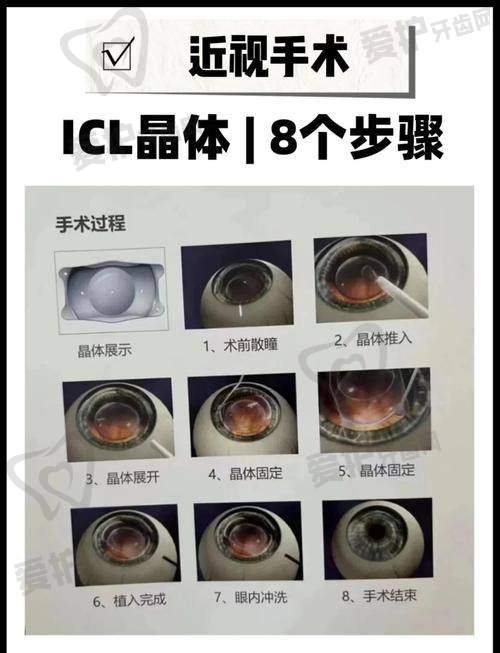 近视眼手术有哪几种方法?全飞秒手术是怎样的?