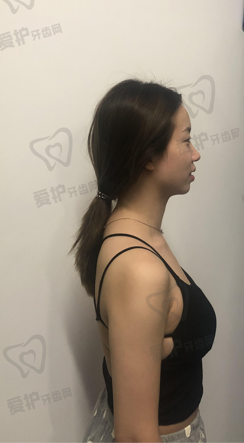 肖征刚医生:隆胸领域的佼佼者