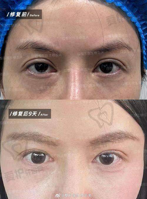 成都军大整形的优势在哪里?