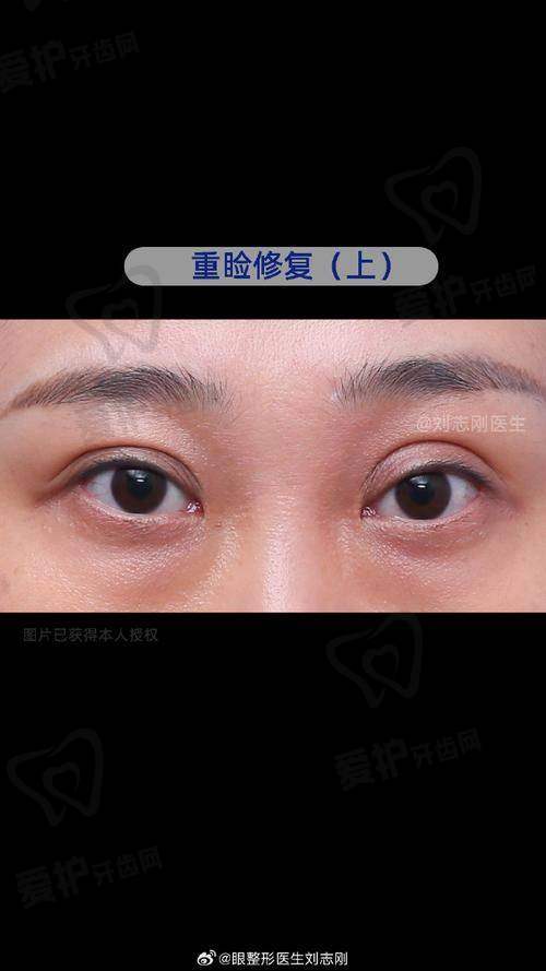 总结
