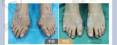 六、湖南湘潭阳光医美门诊部患者评价: