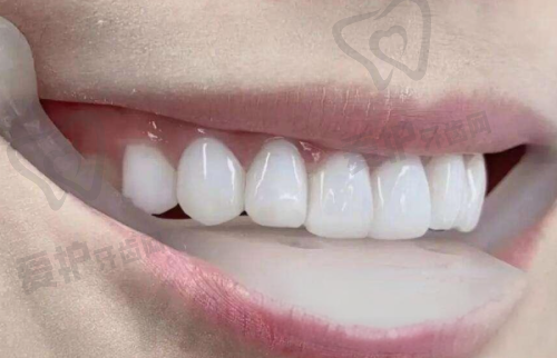 如何前往厦门麦芽口腔医院?