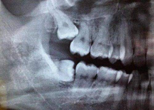 二、贵州盘州雅唯口腔正规吗？