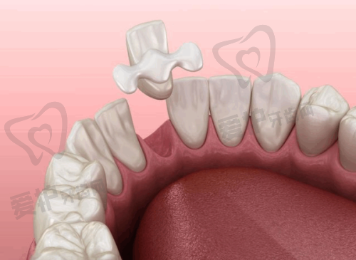 德州德诺口腔刘天晓医生擅长项目