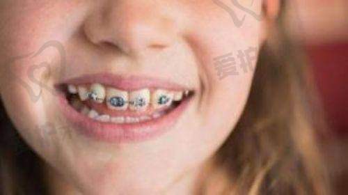 天津诺尔口腔的收费情况是否合理?