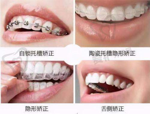 六、贵州盘州雅唯口腔预约挂号流程：