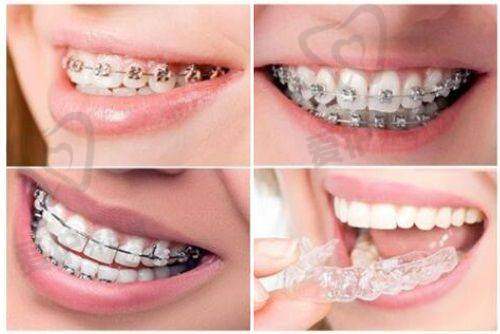 正畸领域:李明辉医生