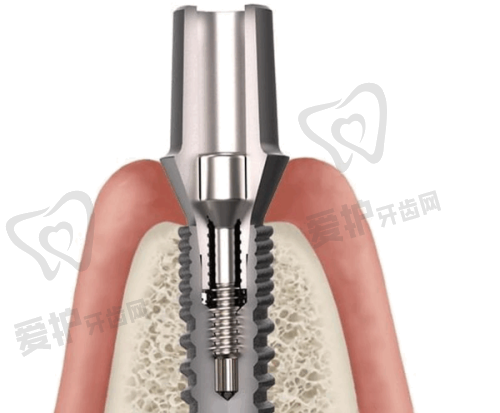 天津蓟州京医口腔医院的医疗团队水平怎么样?