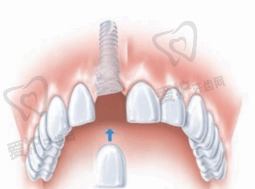 4、盘州雅唯口腔谢圣杰医生社会职称