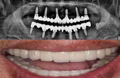 六、乌鲁木齐天使口腔-友好路院区预约挂号流程：