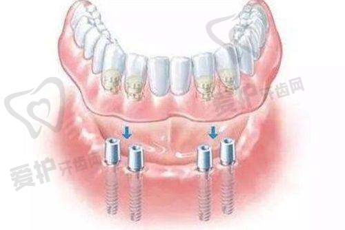 天津诺尔口腔的技术设备是否精良?