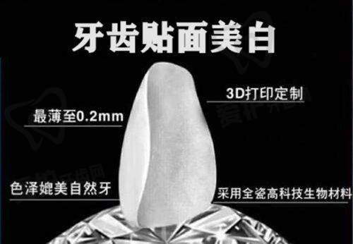 舌侧矫正:与传统矫正有何不同?