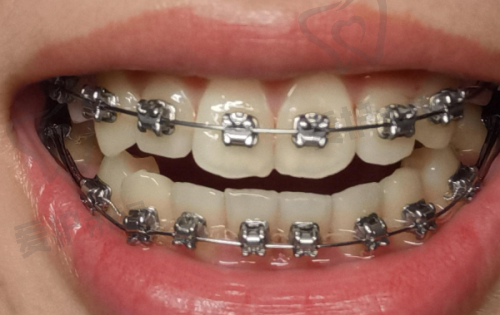 如何预约宁波牙博士口腔医院的就诊?