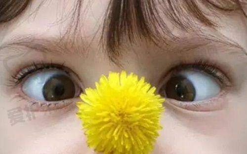 兰州爱尔眼科杨彬医生主刀斜视眼手术，费用6800元起，性价比超高获好评 