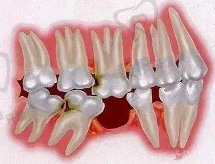 厦门麦芽口腔医院全口活动假牙的患者评价如何?