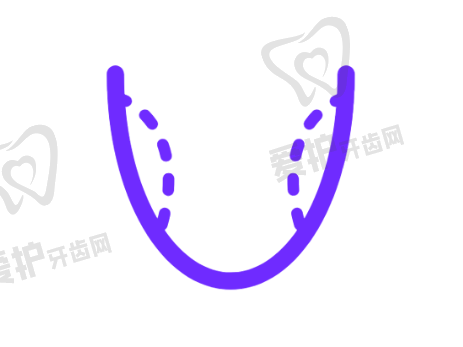 患者实例:舌侧矫正成效如何?