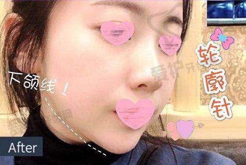 五、南京美兹卡尔医疗美容诊所预约挂号流程：