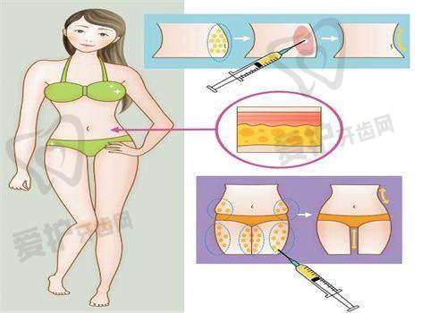 昆明艺星龙海波医生擅长项目: