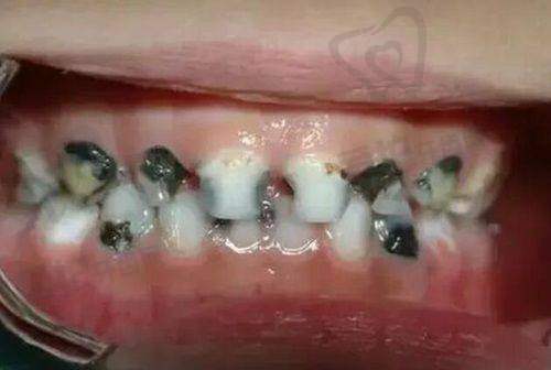 6、上海中喜慧丽口腔曾宪伟医生预约挂号指南